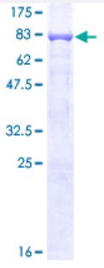 SDS-PAGE (MMP3-5433H).jpg